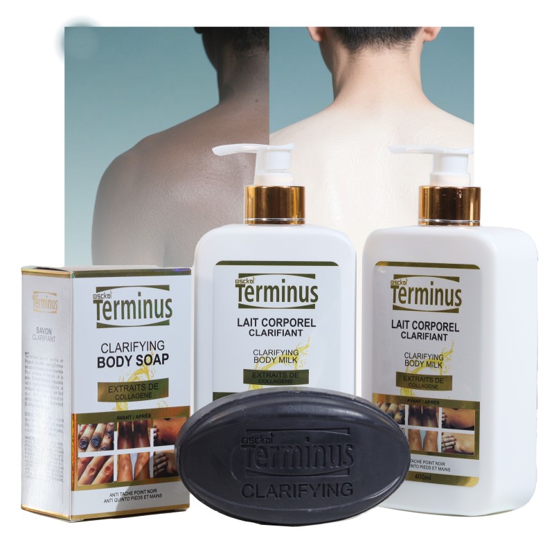 Body Lotion Supplier - Kojic Acid Dark Skin Removal