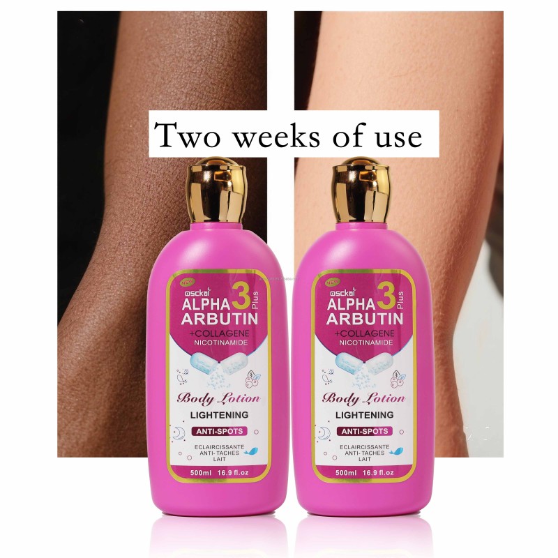 Whitening Lotion Manufacturer - Kojic Lightening Hand Face