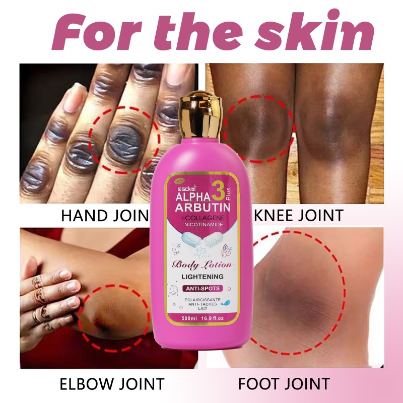 Whitening Lotion Supplier - Alpha Arbutin Collagen 500ml