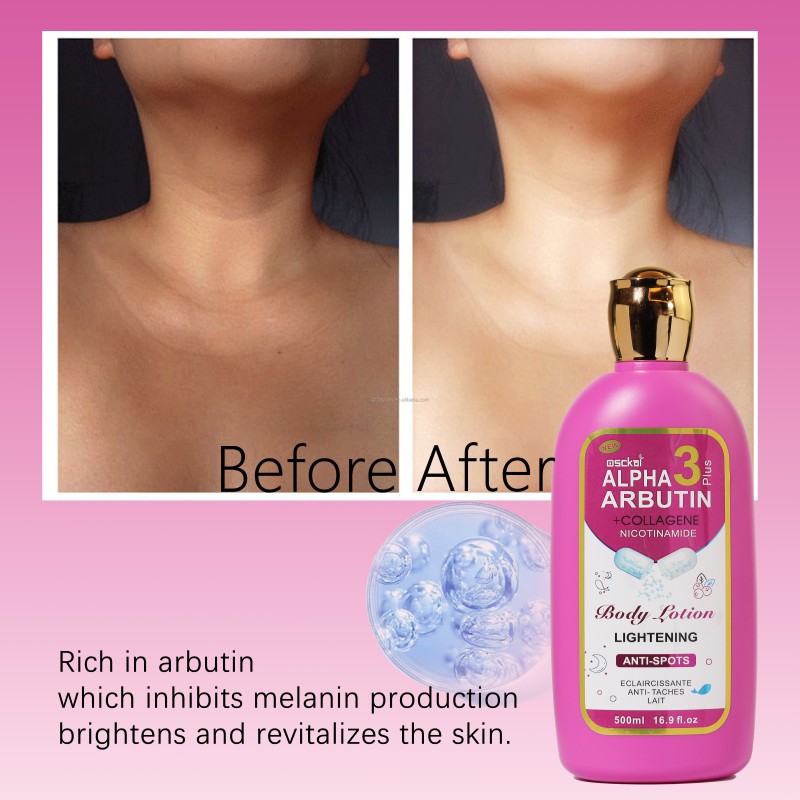 Brightening Lotion Factory - Kojic Acid Dark Spot Corrector