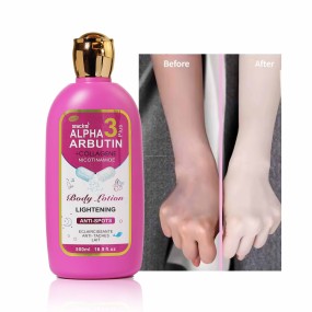 Whitening Lotion Manufacturer - Kojic Lightening Hand Face