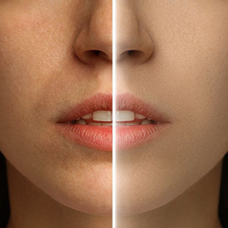 Glutathione Capsules Manufacturer - OEM Antioxidant Vitamin C Whitening