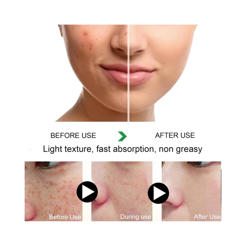 Whitening Capsules Supplier - OEM Anti Melasma DIM KSM-66