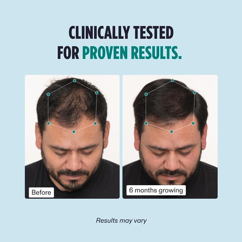 Men's Hair Growth Manufacturer - Clinically Tested Thicker Hair