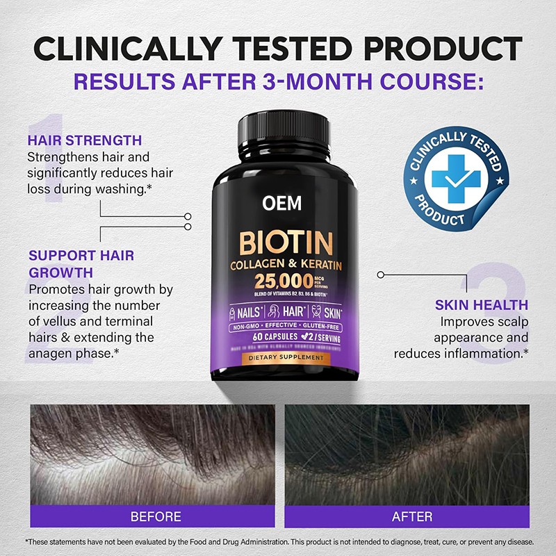 Hair Growth Capsules Manufacturer - OEM Biotin Collagen Skin Nails