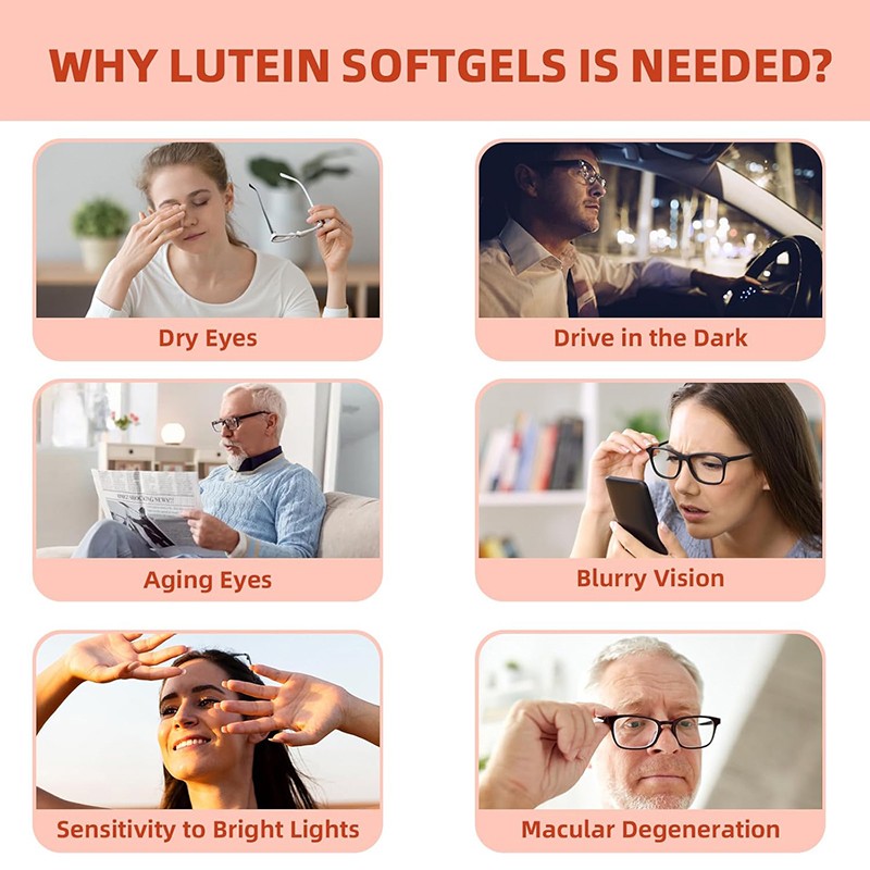 Lutein Softgels Factory - OEM Vitamin C E Eye Skin Antioxidant