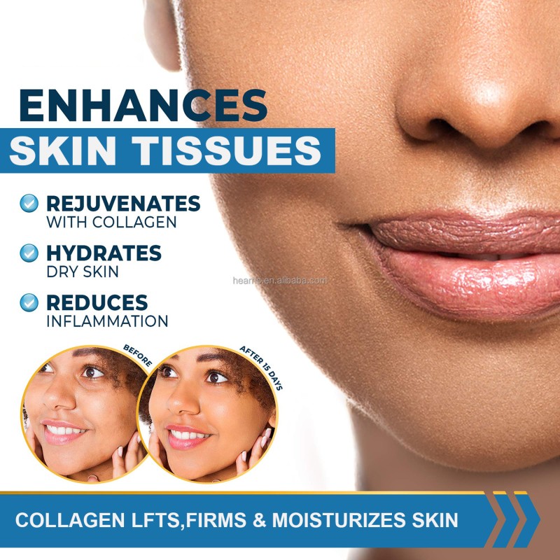 Biotin Collagen Drops Supplier - OEM Strong Hair Growth Beauty