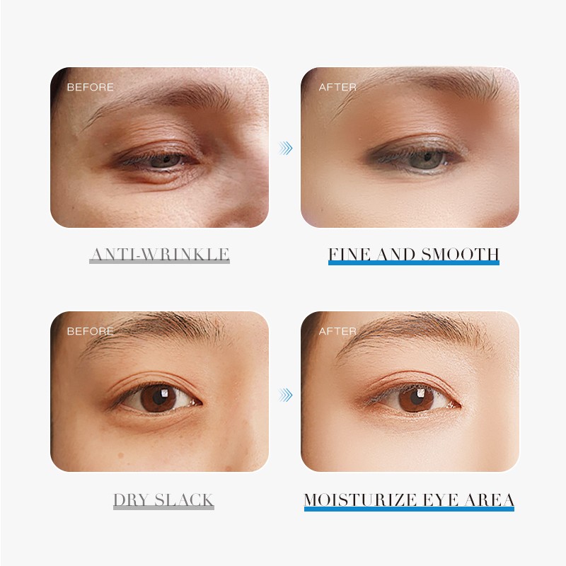 Eye Serum Factory - Natural Anti Aging Eye Bag Remover Roller