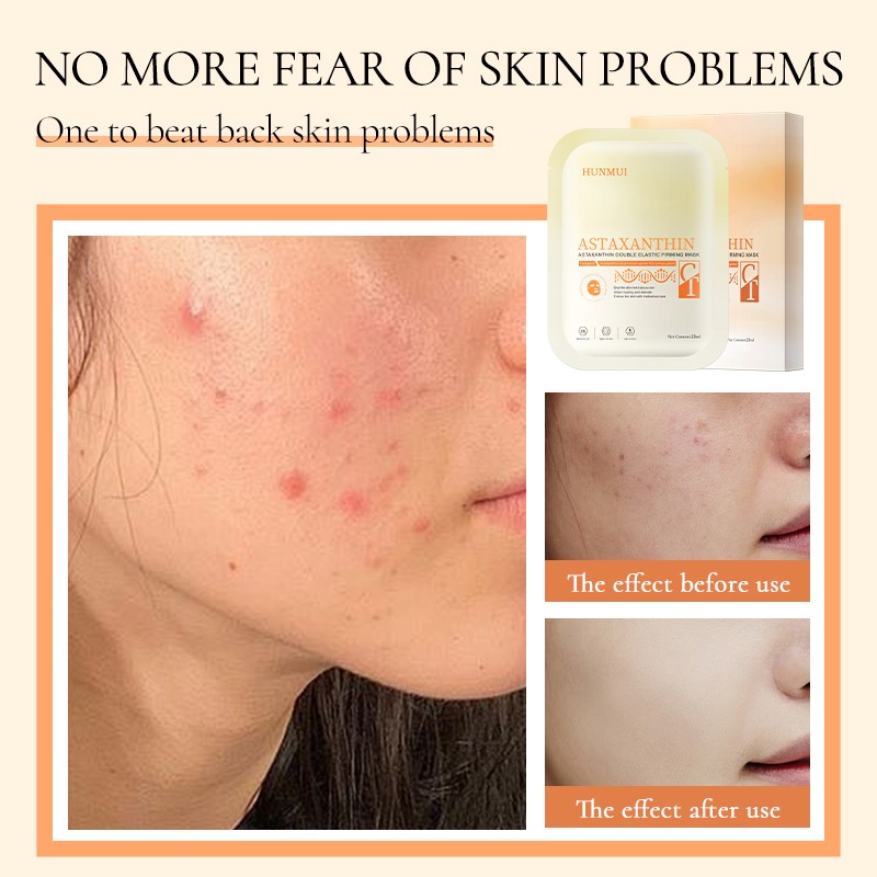 Sleep Patch Manufacturer - Anti Wrinkle Hydrating Easy Absorb