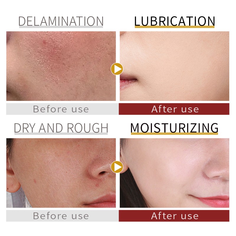 Vitamin E Cream Factory - Custom Wholesale Face Body Moisturizer