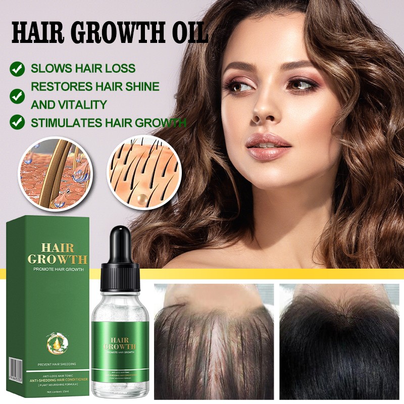 Hair Growth Treatment Manufacturer - Scalp Revitalizing Damage Repair