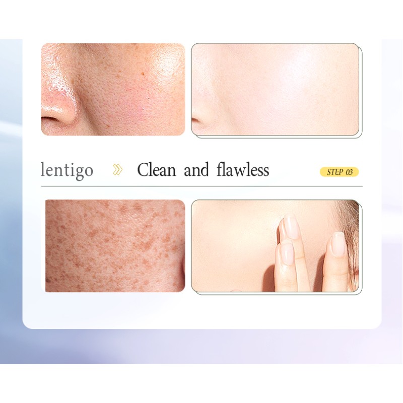 Facial Mask Factory - OEM ODM Whitening Freckle Removing