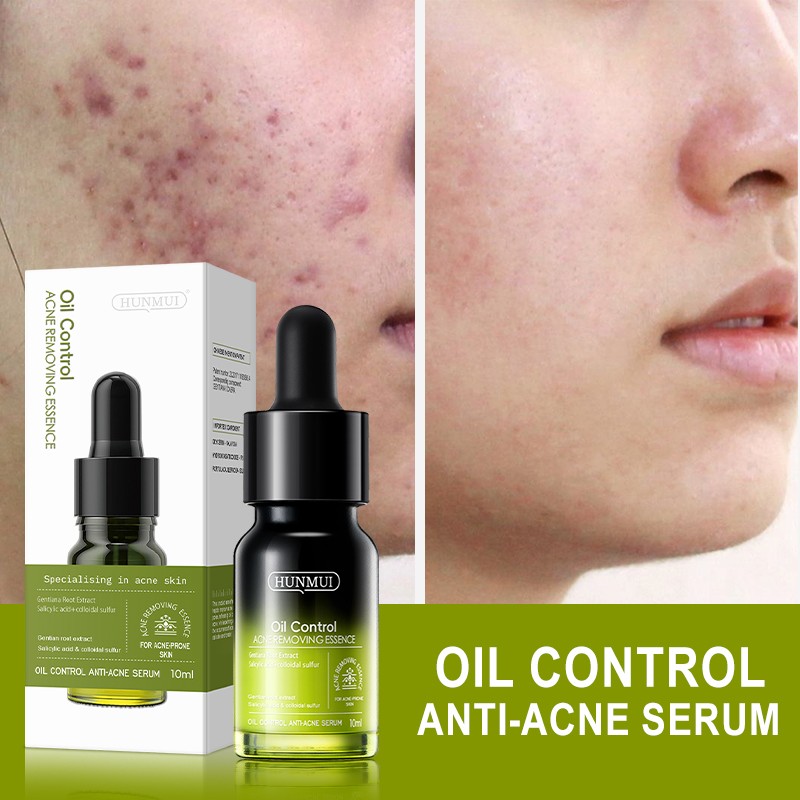 Face Serum Manufacturer - 10ml Pore Shrinking Acne Mark Essence