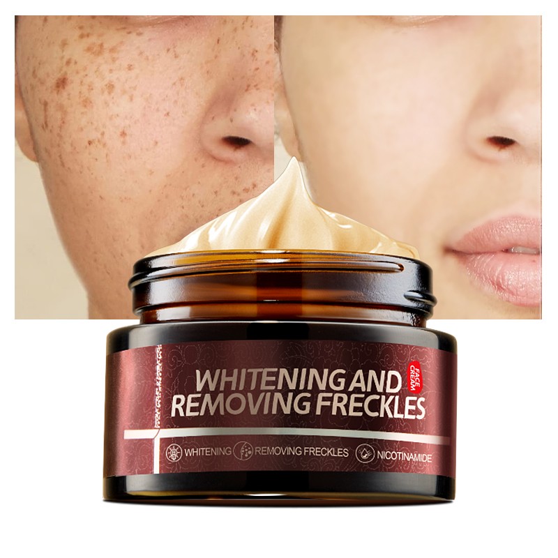 Freckle Cream Manufacturer - OEM Whitening Moisturizing Custom