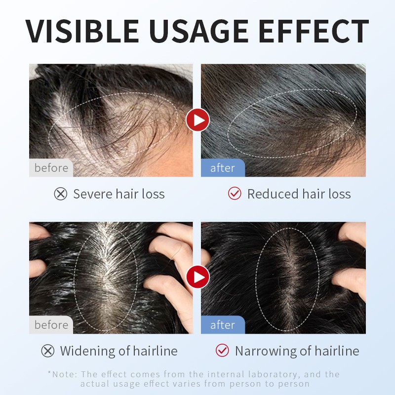 Hair Growth Oil Manufacturer - 2024 Herbal Natural Regrowth