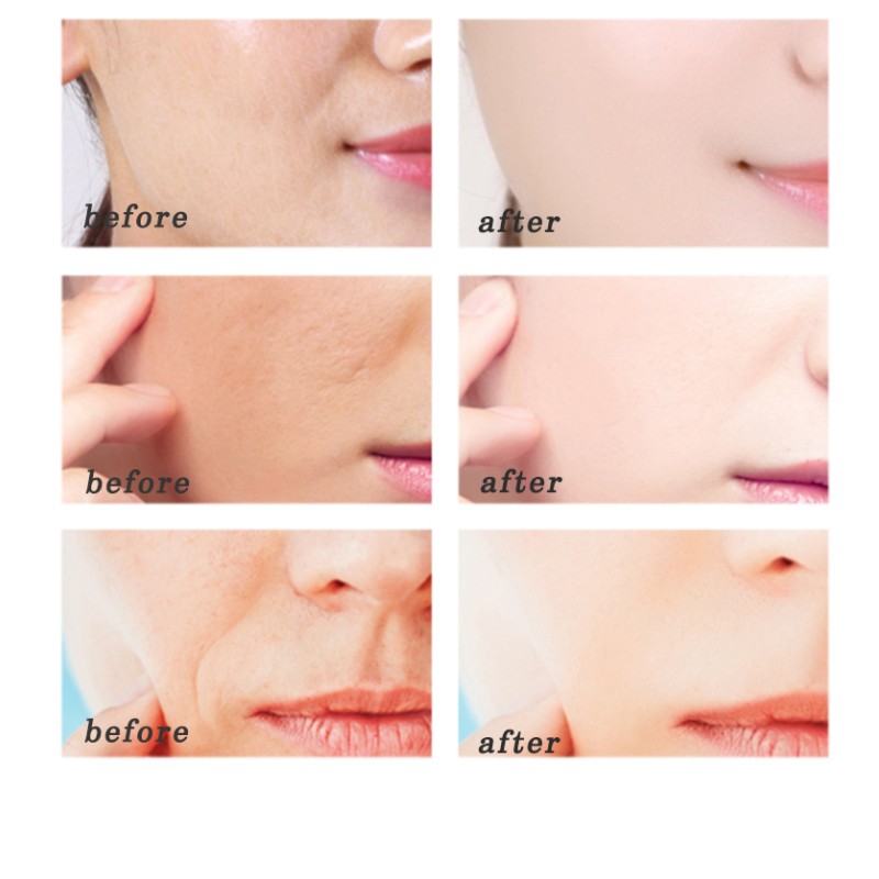 Skin Care Set Factory - Custom Anti Aging Acne Whitening