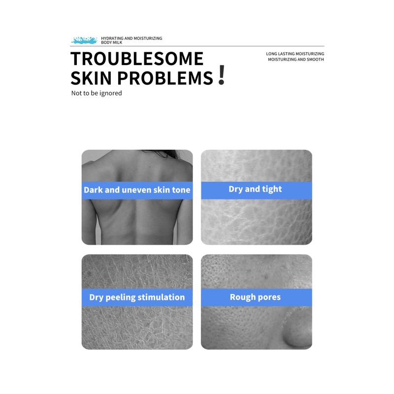 Nicotinamide Lotion Manufacturer - Body Whitening Brightens Skin