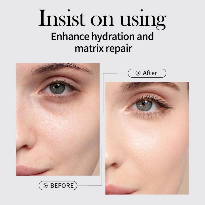 Hyaluronic Acid Toner - Plant-derived Vesicles Care