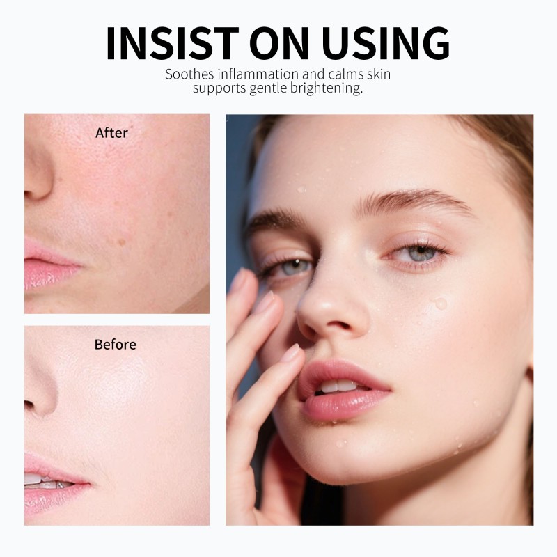 Radiance Serum - Mild AHA Oil-Control Formula