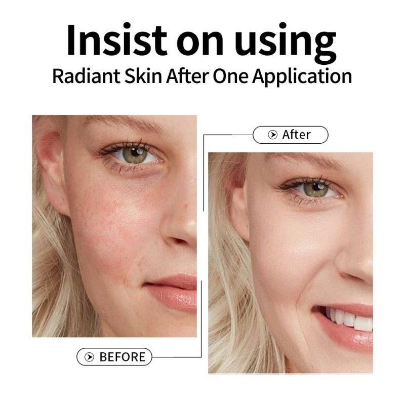 Vitamin C Serum - Hyaluronic Acid Anti-Aging