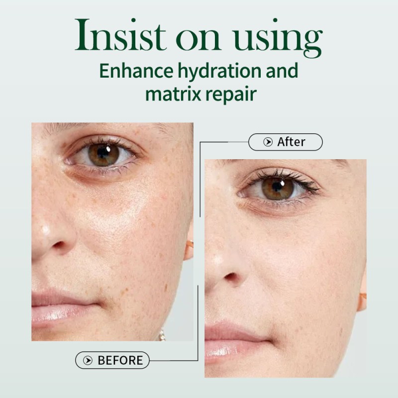 Rose PDRN Serum - Collagen Peptides Plumping Care