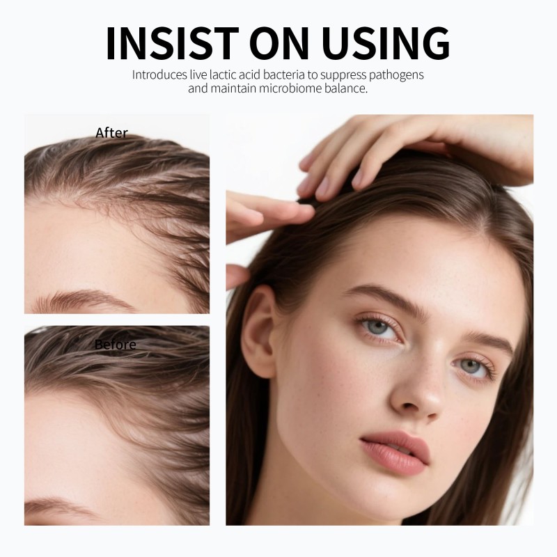 Hair Growth Serum - Thuja Orientalis Strengthening