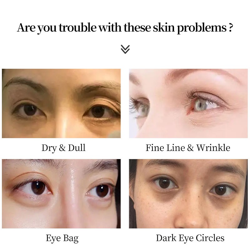 Eye Cream Manufacturer - Private Label Dark Circle Wrinkle Removal
