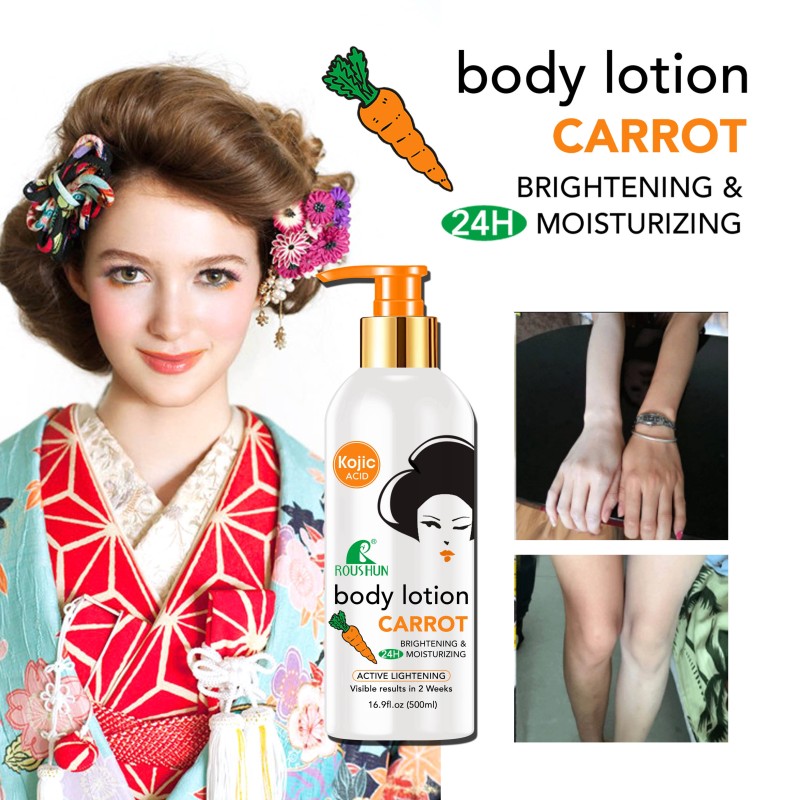 Kojic Body Lotion - OEM Whitening Cream