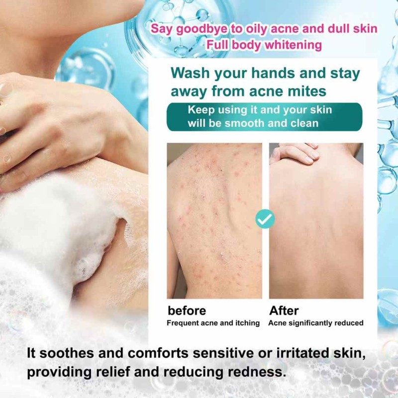 Whitening Soap - Kojic Acid Turmeric Bath Soap