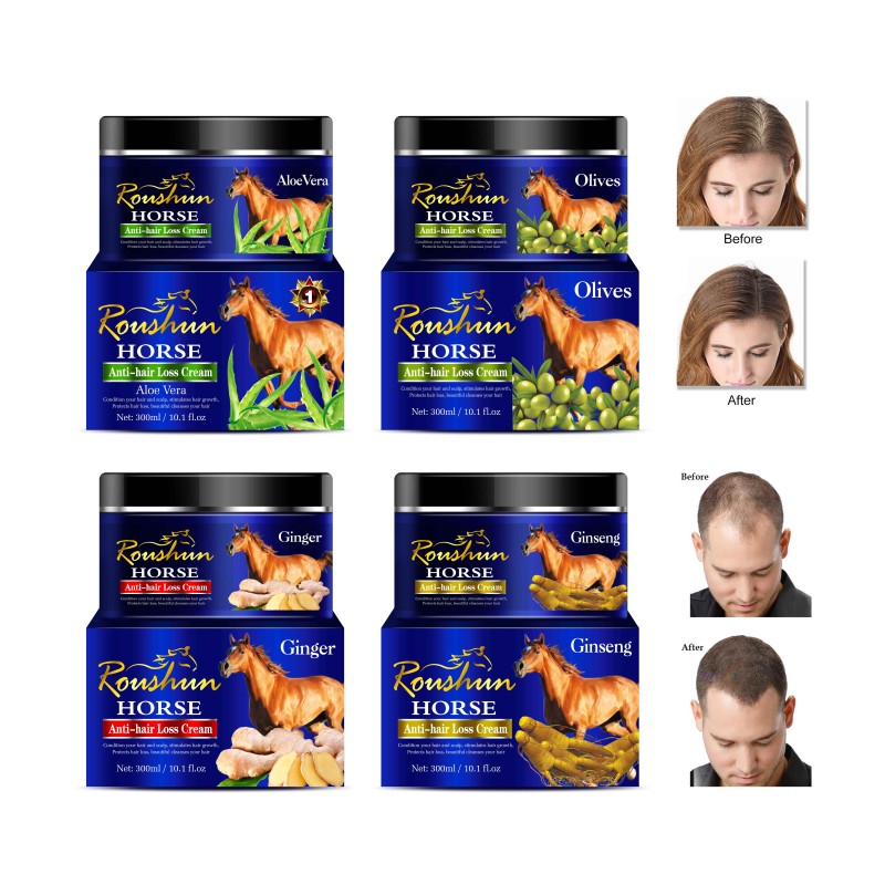Hair Treatment - Anti Hair Loss Conditioner Factory
