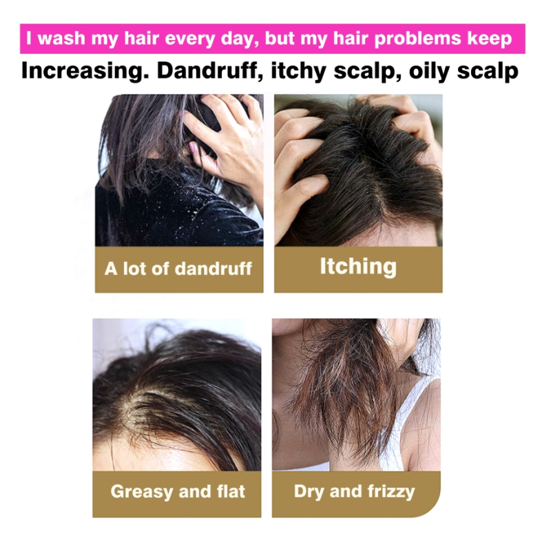 Shampoo - Aloe Vera Anti Lice Control