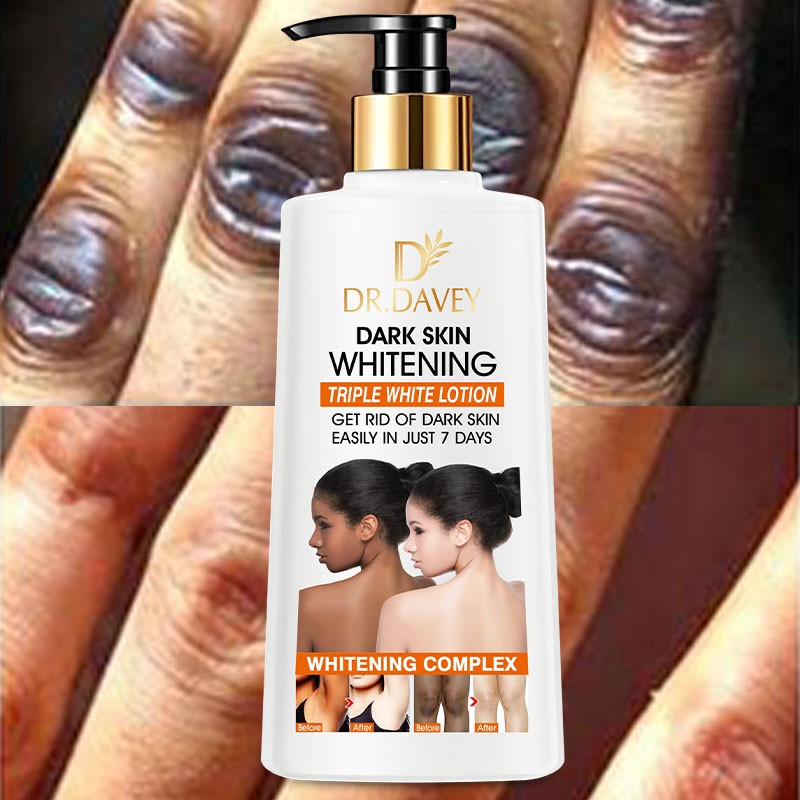 Whitening Body Lotion - Hand Face Moisturizing Cream