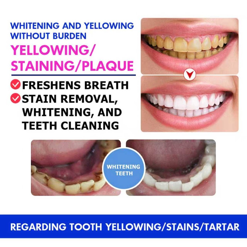 Teeth Whitening Powder - Private Label Stain Remove