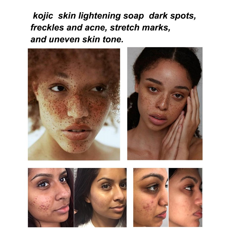 Kojic Acid Soap - Whitening Bar Soap Wholesale