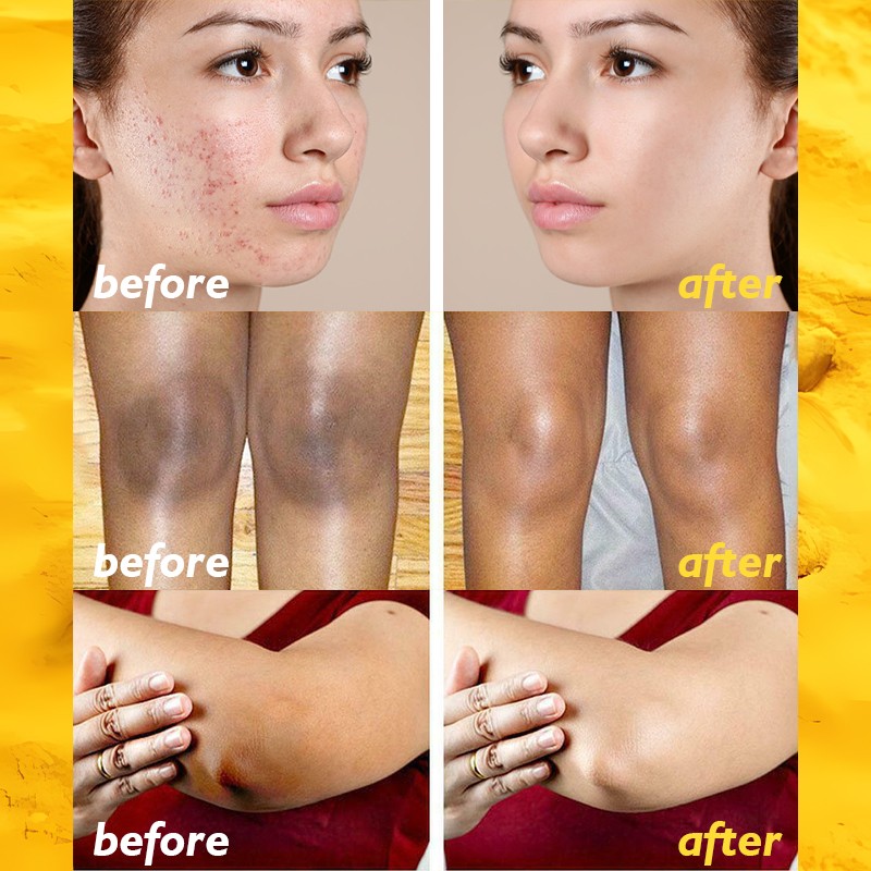 Skin Care Kit - Vitamin C Turmeric Brightening