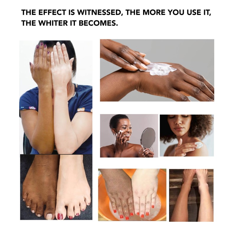 Kojic Body Lotion - OEM Whitening Cream