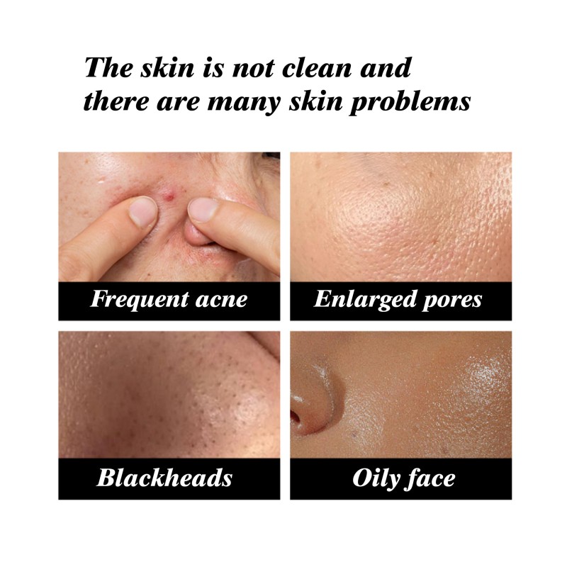 Face Soap - Turmeric Vitamin C Lightening Bar