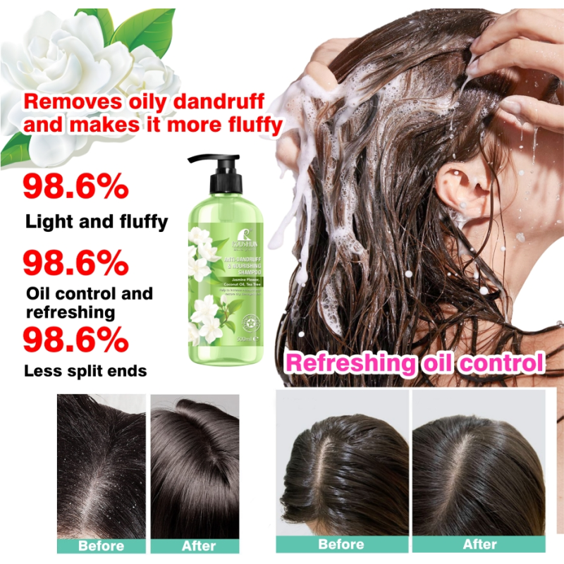Shampoo - Aloe Vera Anti Lice Control