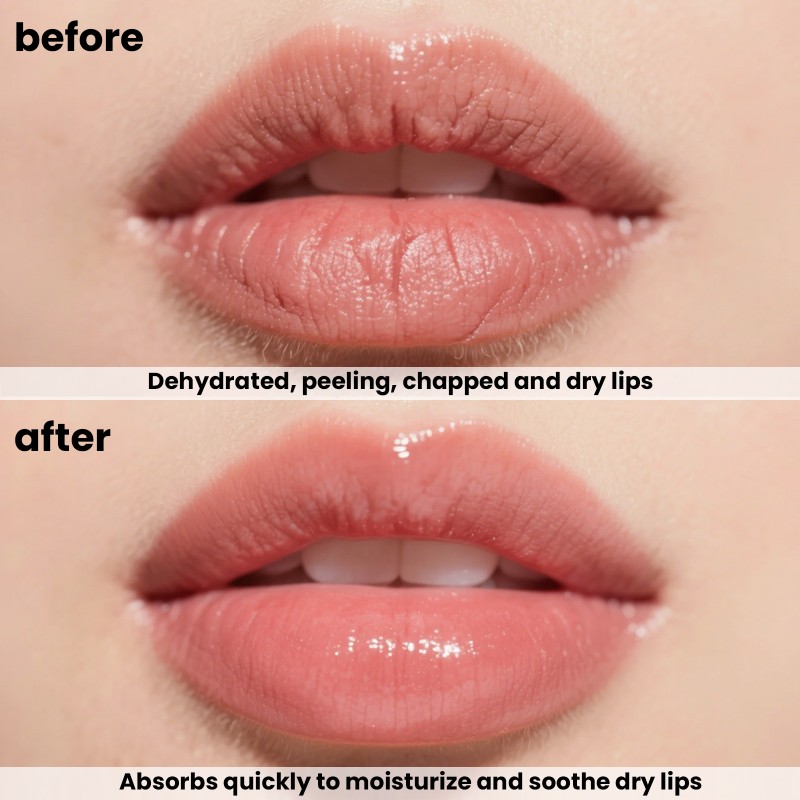 Lip Balm Manufacturer - Vegan Peptide Moisturizing Gel Wholesale