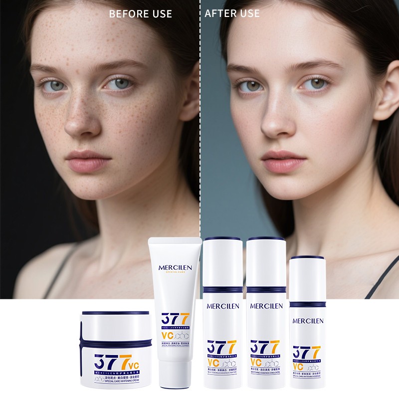 Skin Care Set - 5 Piece Whitening Series