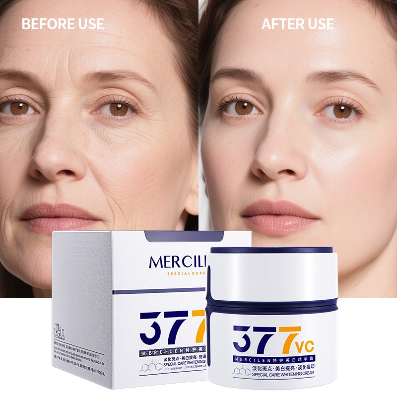 Whitening Cream - Hyperpigmentation Acne Marks