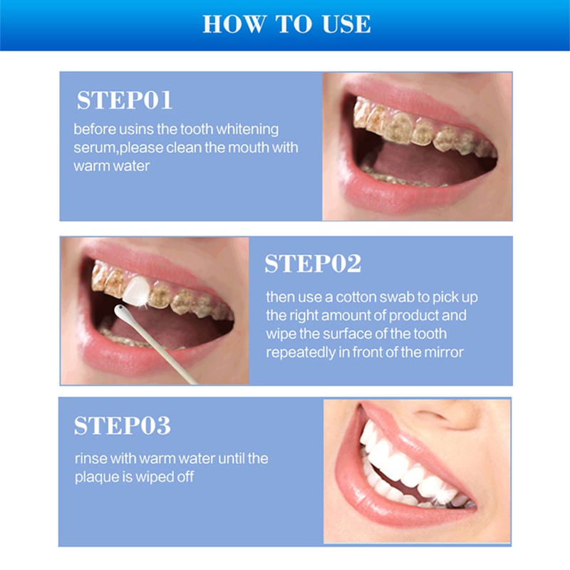 Teeth Whitening Gel - 10ml Dental Essence Supplier