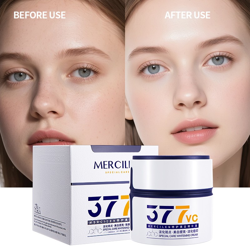 Whitening Cream - Hyperpigmentation Acne Marks
