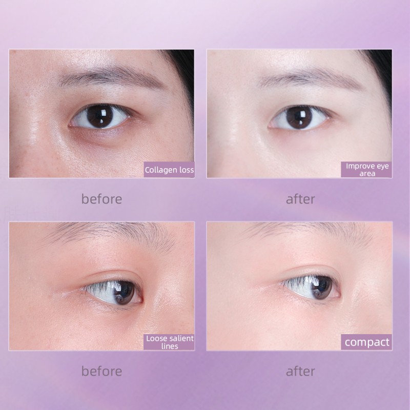 Eye Essence - Collagen Anti-Wrinkle Elasticity