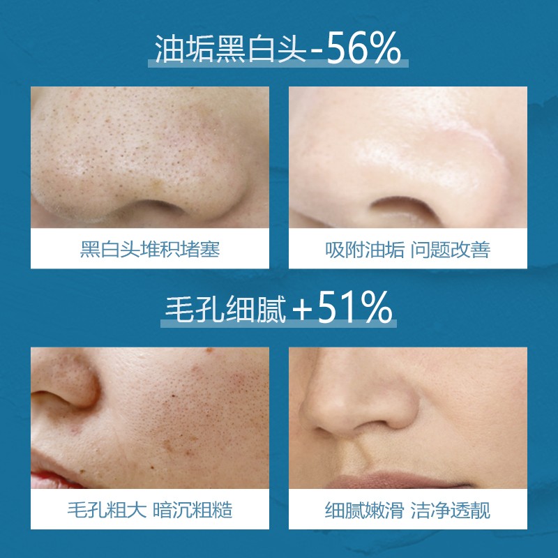 Clay Mask - Pore Cleansing Acne Treatment