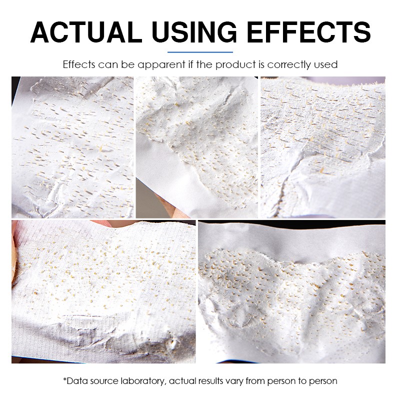 Facial Mud Mask - Hydrating Acne Treatment Whitening