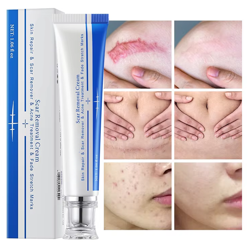 Skin Repair Gel - Acne Mark Stretch Mark Care