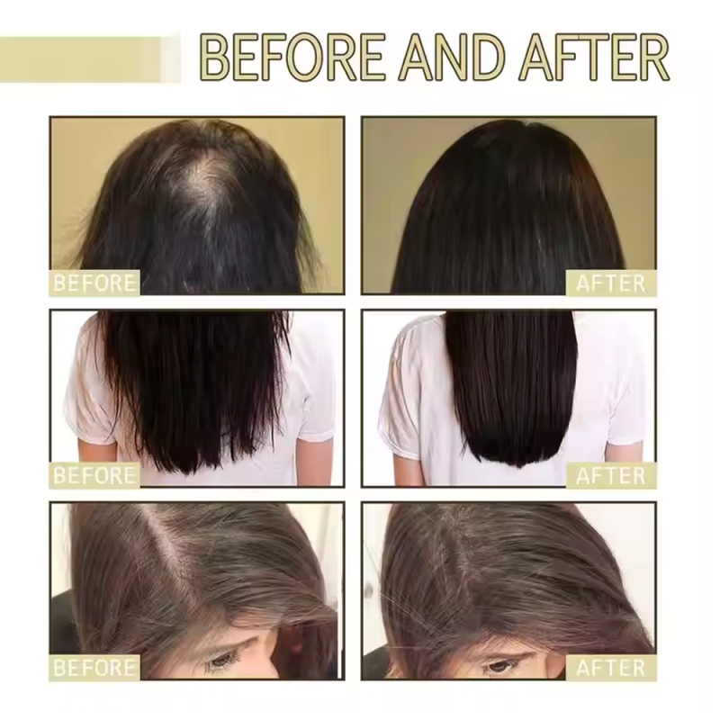 Hair Growth Serum - Organic Castor Almond Oil