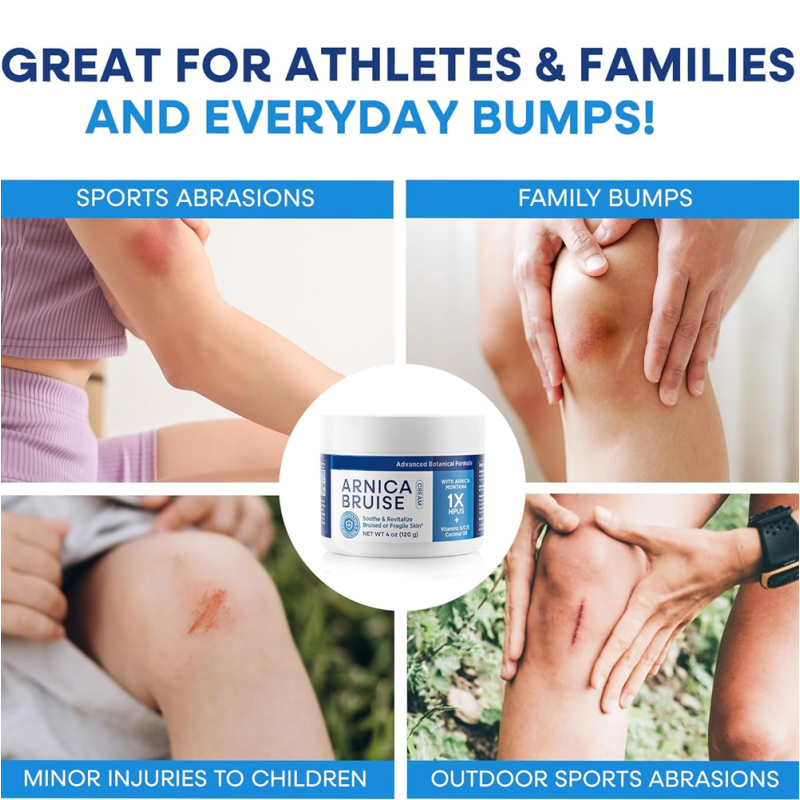 Body Lotion 4oz - Fast Acting Bruise Care