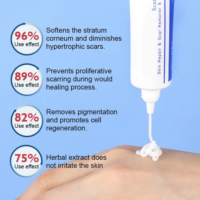 Skin Repair Gel - Acne Mark Stretch Mark Care